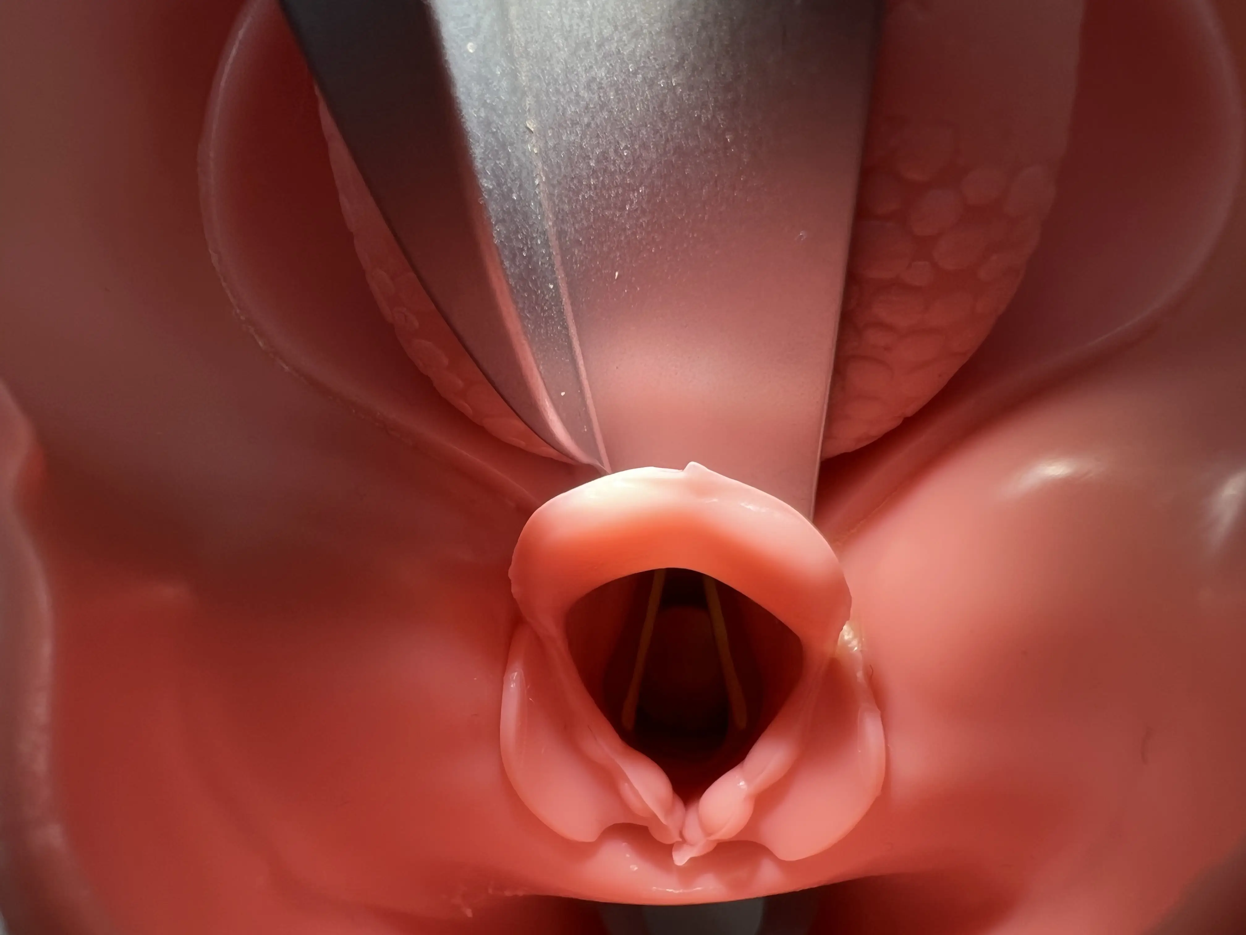 Atemwegsmanagement sicher strukturieren – Von Oxygenierung bis Intubation